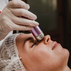 Laser Facial Treatments